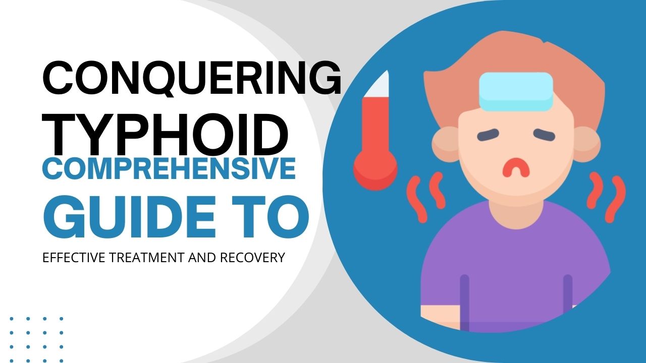 Conquering Typhoid: Comprehensive Guide to Effective Treatment and Recovery